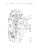 Surgical Stapler Having an Adjustment Feature diagram and image