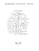 Surgical Stapler Having an Adjustment Feature diagram and image