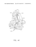 Surgical Stapler Having an Adjustment Feature diagram and image