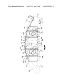 ANTI-EJECTION INFLATABLE VEHICLE OCCUPANT PROTECTION DEVICE diagram and image