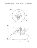 MECHANICALLY FLEXIBLE MAGNETIC RESONANCE COIL WITH OPENING CONDUCTOR     STRUCTURES diagram and image