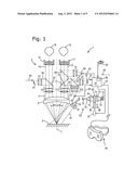 Microscopy System, Microscopy Method and a Method of Treating an Aneurysm diagram and image