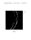 COMPUTER-AIDED DIAGNOSIS OF RETINAL PATHOLOGIES USING FRONTAL EN-FACE     VIEWS OF OPTICAL COHERENCE TOMOGRAPHY diagram and image