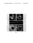 COMPUTER-AIDED DIAGNOSIS OF RETINAL PATHOLOGIES USING FRONTAL EN-FACE     VIEWS OF OPTICAL COHERENCE TOMOGRAPHY diagram and image