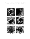 COMPUTER-AIDED DIAGNOSIS OF RETINAL PATHOLOGIES USING FRONTAL EN-FACE     VIEWS OF OPTICAL COHERENCE TOMOGRAPHY diagram and image