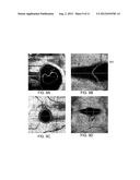 COMPUTER-AIDED DIAGNOSIS OF RETINAL PATHOLOGIES USING FRONTAL EN-FACE     VIEWS OF OPTICAL COHERENCE TOMOGRAPHY diagram and image