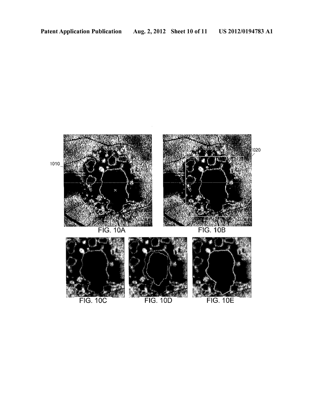 COMPUTER-AIDED DIAGNOSIS OF RETINAL PATHOLOGIES USING FRONTAL EN-FACE     VIEWS OF OPTICAL COHERENCE TOMOGRAPHY - diagram, schematic, and image 11