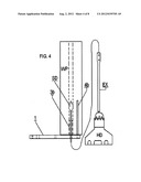 Drill guide apparatus diagram and image