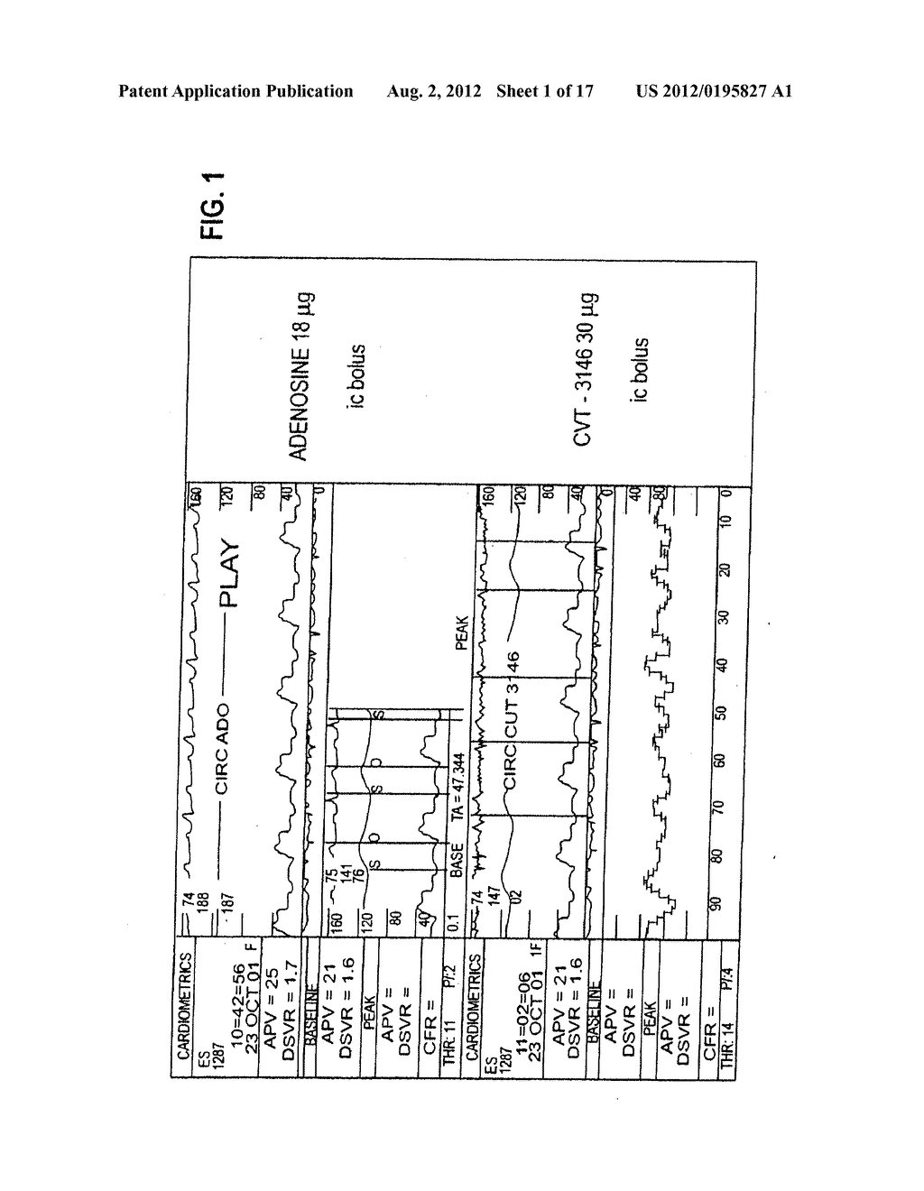 MYOCARDIAL PERFUSION IMAGING METHODS AND COMPOSITIONS - diagram, schematic, and image 02