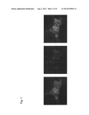 Monoclonal Antibodies Against Claudin-18 For Treatment of Cancer diagram and image