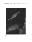 Monoclonal Antibodies Against Claudin-18 For Treatment of Cancer diagram and image