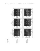 Monoclonal Antibodies Against Claudin-18 For Treatment of Cancer diagram and image