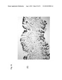 Monoclonal Antibodies Against Claudin-18 For Treatment of Cancer diagram and image