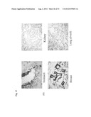 Monoclonal Antibodies Against Claudin-18 For Treatment of Cancer diagram and image