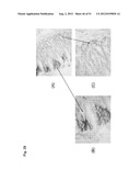 Monoclonal Antibodies Against Claudin-18 For Treatment of Cancer diagram and image