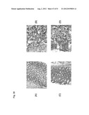 Monoclonal Antibodies Against Claudin-18 For Treatment of Cancer diagram and image