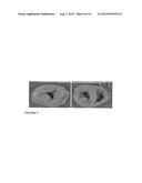 PARENTERAL COMPOSITION COMPRISING MICROSPHERES WITH A DIAMETER BETWEEN 10     AND 20 MICRONS diagram and image