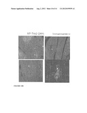 PARENTERAL COMPOSITION COMPRISING MICROSPHERES WITH A DIAMETER BETWEEN 10     AND 20 MICRONS diagram and image