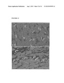 PARENTERAL COMPOSITION COMPRISING MICROSPHERES WITH A DIAMETER BETWEEN 10     AND 20 MICRONS diagram and image