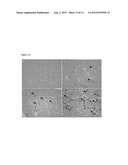 PARENTERAL COMPOSITION COMPRISING MICROSPHERES WITH A DIAMETER BETWEEN 10     AND 20 MICRONS diagram and image