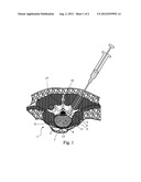 IMPLANTABLE MATRIX HAVING OPTIMUM LIGAND CONCENTRATIONS diagram and image