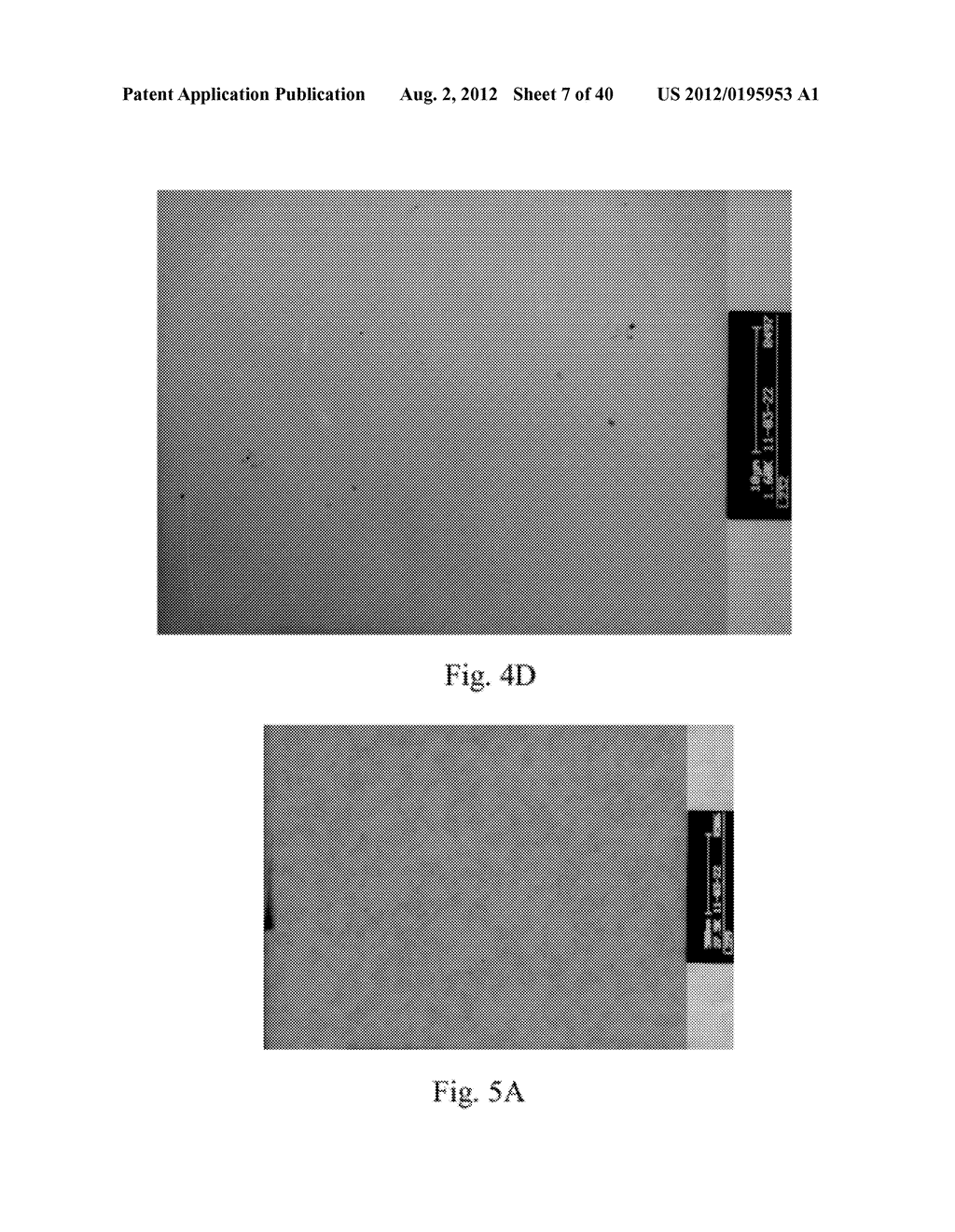 Fibrin sealant (FIBRINGLURAAS) consisting of a kit of lyophilized high     concentrate fribinogen intentionally enriched and preserved with     fibronolysis inhibitor A1AT - diagram, schematic, and image 08