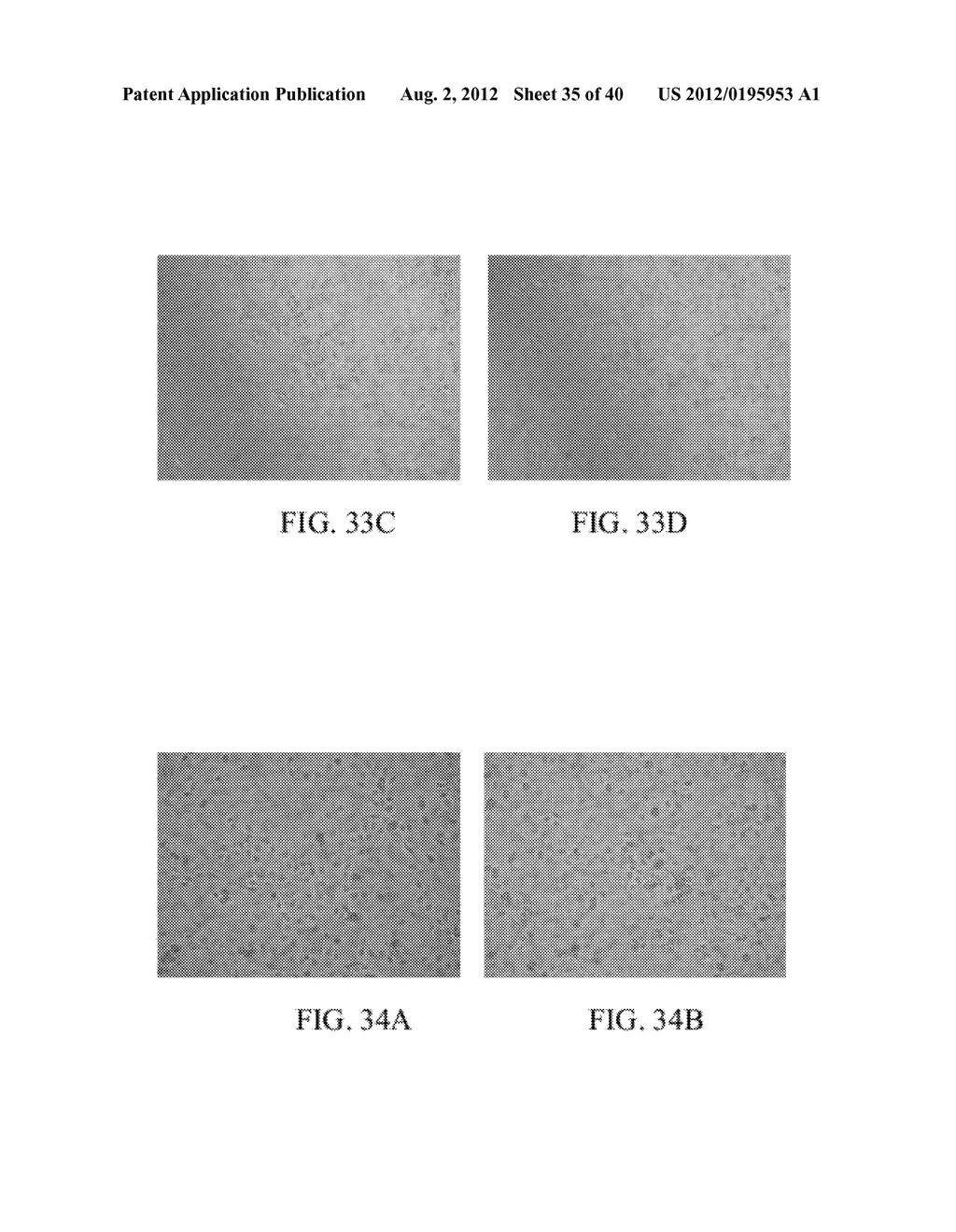 Fibrin sealant (FIBRINGLURAAS) consisting of a kit of lyophilized high     concentrate fribinogen intentionally enriched and preserved with     fibronolysis inhibitor A1AT - diagram, schematic, and image 36