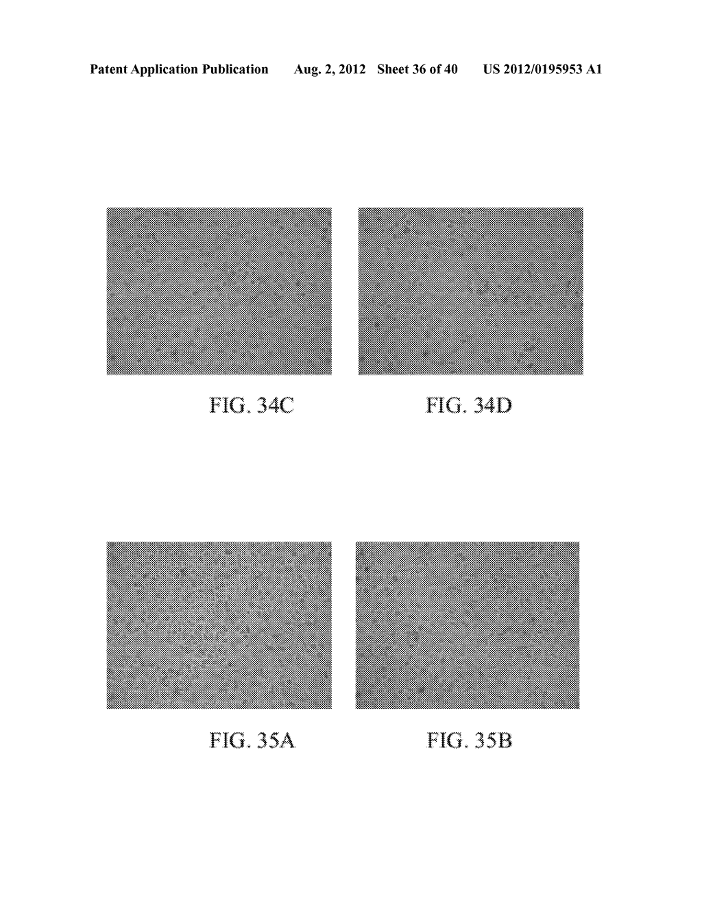 Fibrin sealant (FIBRINGLURAAS) consisting of a kit of lyophilized high     concentrate fribinogen intentionally enriched and preserved with     fibronolysis inhibitor A1AT - diagram, schematic, and image 37