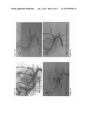 TREATMENT OF SPECIFIC CARDIOVASCULAR CONDITIONS WITH NITRITE diagram and image