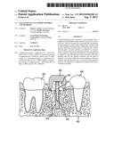 ANGLED DENTAL PLATFORM ASSEMBLY AND METHODS diagram and image