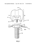 ANGLED DENTAL PLATFORM ASSEMBLY AND METHODS diagram and image