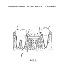 ANGLED DENTAL PLATFORM ASSEMBLY AND METHODS diagram and image