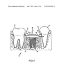 ANGLED DENTAL PLATFORM ASSEMBLY AND METHODS diagram and image