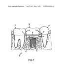 ANGLED DENTAL PLATFORM ASSEMBLY AND METHODS diagram and image