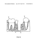 ANGLED DENTAL PLATFORM ASSEMBLY AND METHODS diagram and image