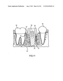 ANGLED DENTAL PLATFORM ASSEMBLY AND METHODS diagram and image