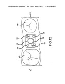 ANGLED DENTAL PLATFORM ASSEMBLY AND METHODS diagram and image