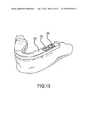 ANGLED DENTAL PLATFORM ASSEMBLY AND METHODS diagram and image