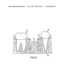 ANGLED DENTAL PLATFORM ASSEMBLY AND METHODS diagram and image