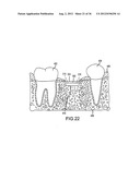 ANGLED DENTAL PLATFORM ASSEMBLY AND METHODS diagram and image