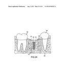 ANGLED DENTAL PLATFORM ASSEMBLY AND METHODS diagram and image