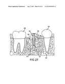 ANGLED DENTAL PLATFORM ASSEMBLY AND METHODS diagram and image