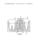 ANGLED DENTAL PLATFORM ASSEMBLY AND METHODS diagram and image