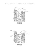 ANGLED DENTAL PLATFORM ASSEMBLY AND METHODS diagram and image