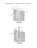 ANGLED DENTAL PLATFORM ASSEMBLY AND METHODS diagram and image