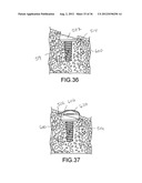 ANGLED DENTAL PLATFORM ASSEMBLY AND METHODS diagram and image