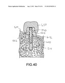 ANGLED DENTAL PLATFORM ASSEMBLY AND METHODS diagram and image