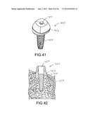 ANGLED DENTAL PLATFORM ASSEMBLY AND METHODS diagram and image