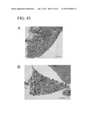 METHODS AND PRODUCTS FOR TREATING INFLAMMATION diagram and image