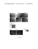 UBIQUITIN INTERACTING MOTIF PEPTIDES AS CANCER THERAPEUTICS diagram and image